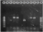 Ứng dụng kỹ thuật PCR phát hiện nấm Candida spp gây bệnh